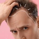 Hair Growth Doctor in Reston VA