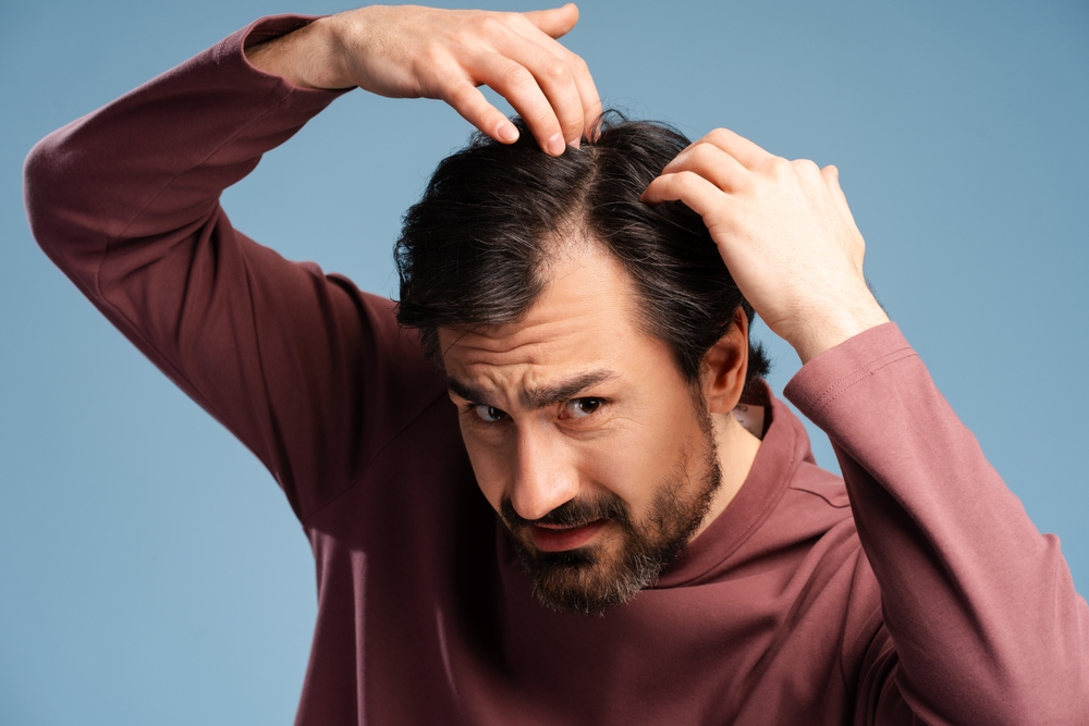 Alma TED: Hair Loss Treatment Reston VA