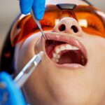 Emergency Dentists in Reston VA