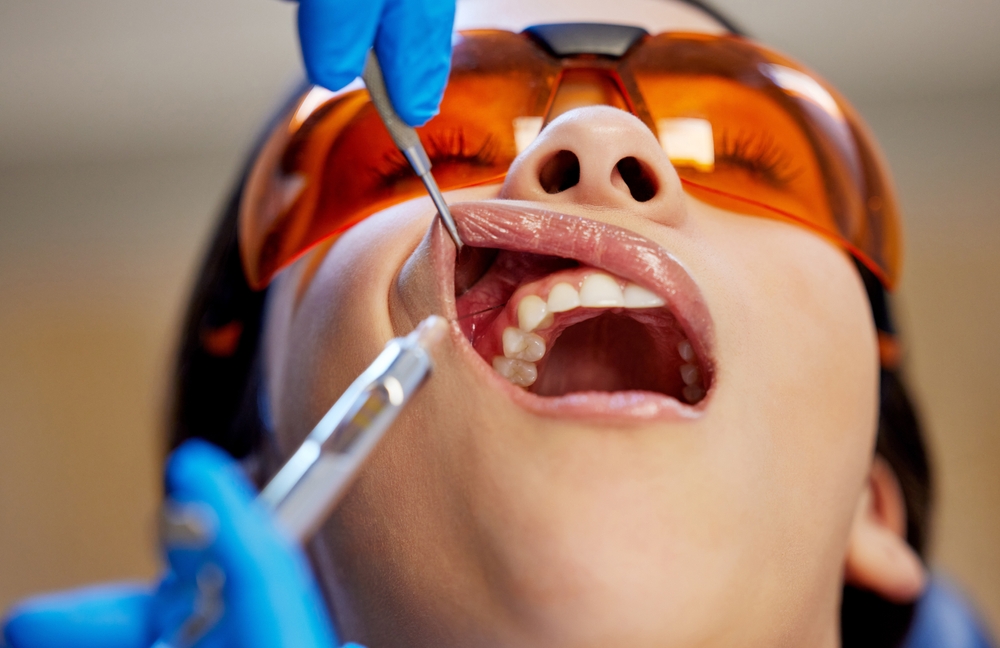 Emergency Dentists in Reston VA