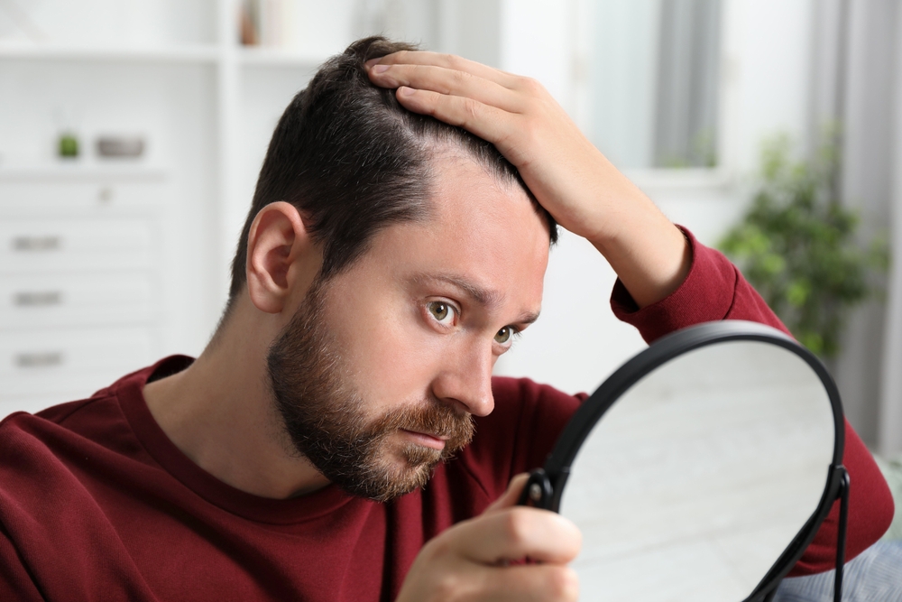 Top Hair Loss Specialists in Reston, VA: Effective Treatments for Thinning Hair