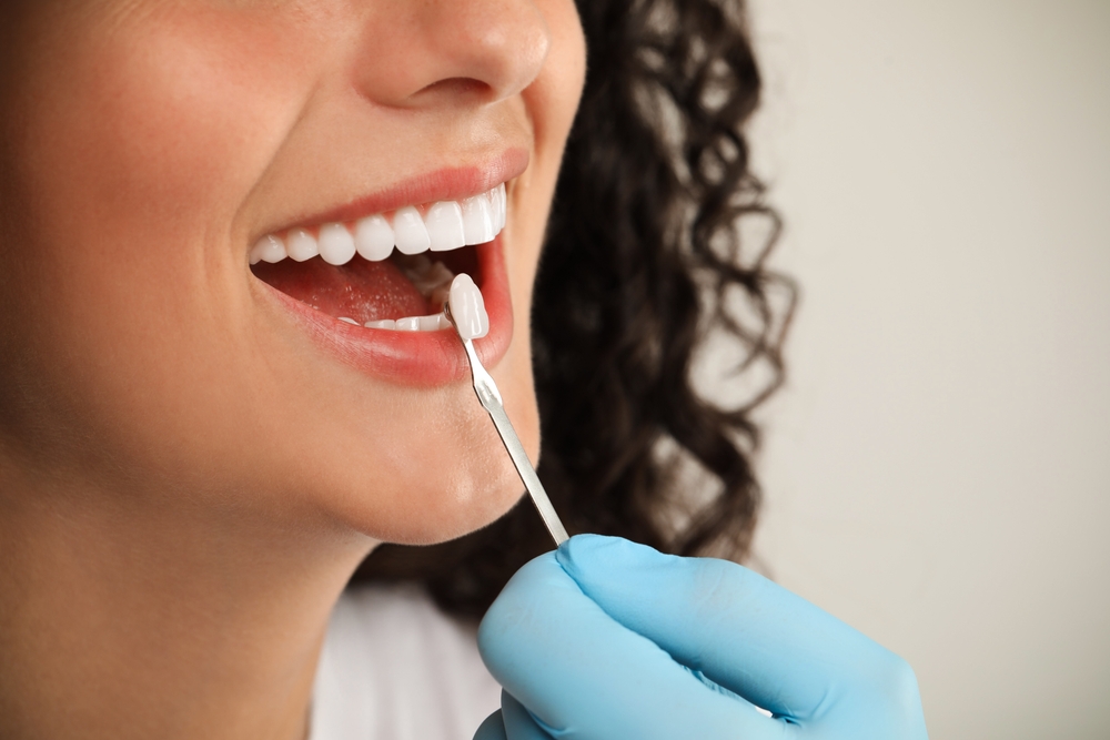 Same-Day Dental Crown Services in Reston, Virginia