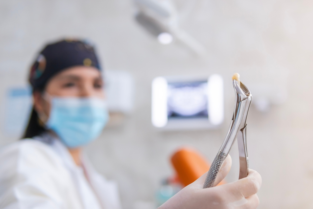 Same-Day Tooth Extraction in Reston